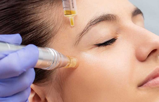 Skin and laser treatment